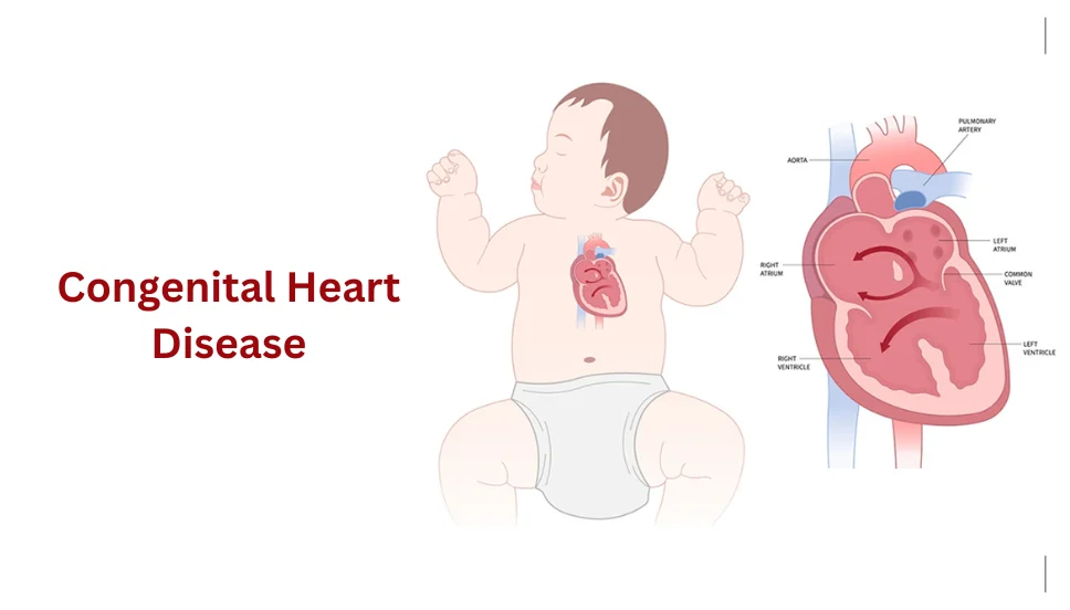 Congenital Heart Disease in Gorakhpur