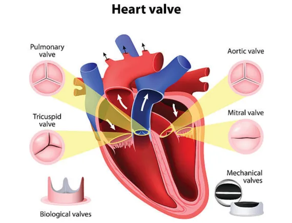 Heart valve problems treatment in Gorakhpur
