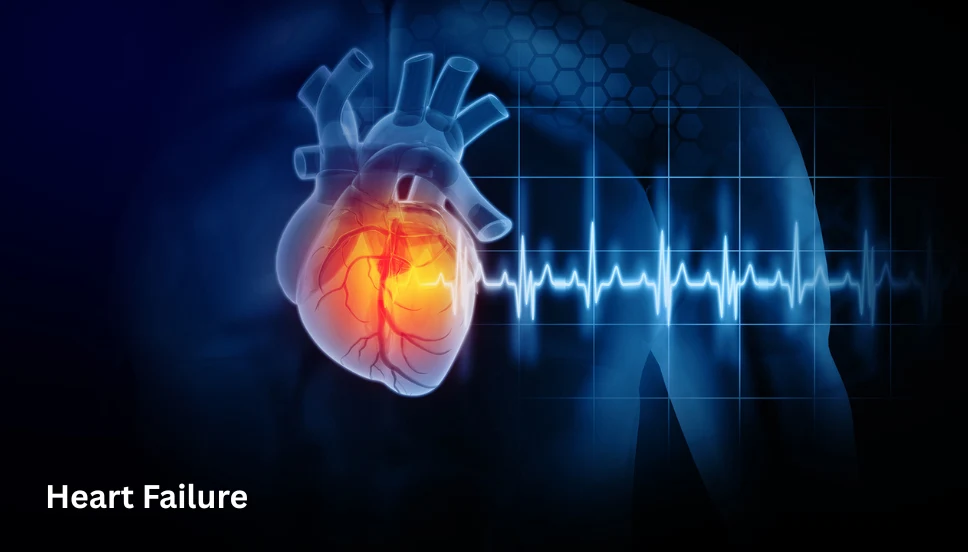 Heart Failure treatment in Gorakhpur