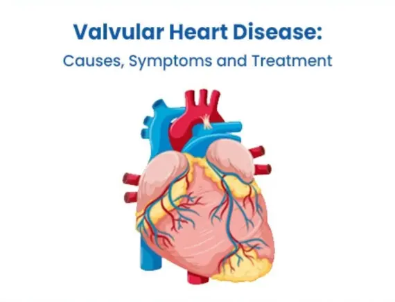 Valvular Heart Disease Treatment in Gorakhpur